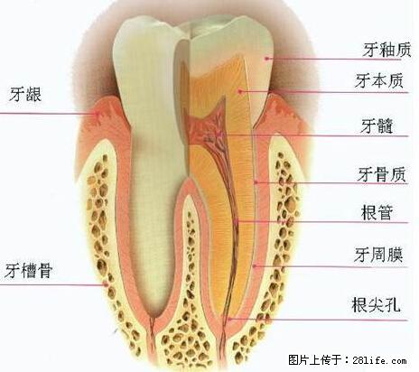 牙齿做了根管治疗装了牙套后悔死（此帖给牙病患者看） - 生活百科 - 桂林生活社区 - 桂林28生活网 www.28life.net