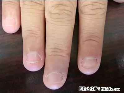 剪指甲、挖耳屎，这些日常小动作竟隐藏大危害！ - 生活百科 - 桂林生活社区 - 桂林28生活网 www.28life.net