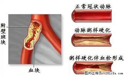 原来海带不能乱吃…现在知道还不晚哦！ - 生活百科 - 桂林生活社区 - 桂林28生活网 www.28life.net